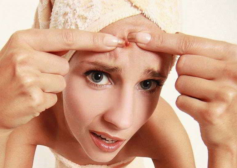 Classement des meilleurs remèdes peu coûteux contre l'acné sur le visage en 2020